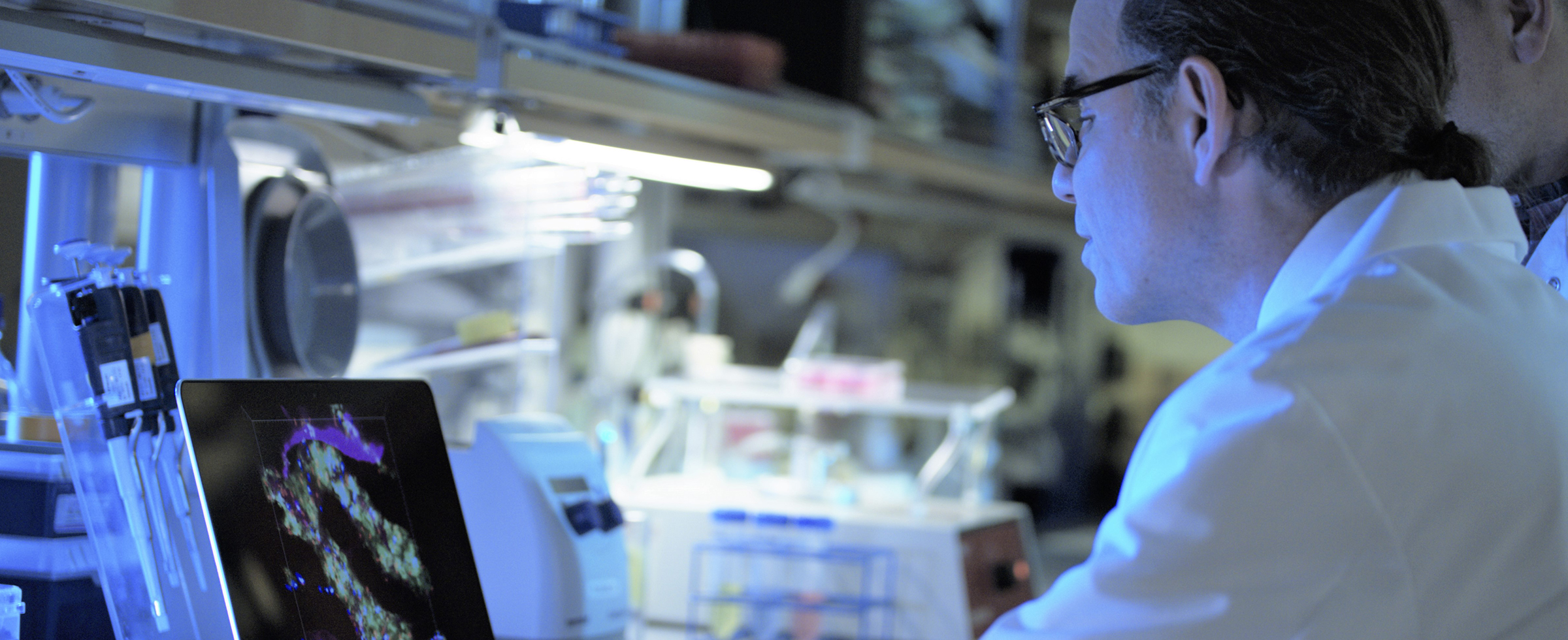 Dr. Warren Shlomchik investigates the biology of transplanting blood stem cells from one person to another. These transplants are usually performed to treat blood cancers. Through his studies Dr. Shlomchik works to improve the safety and effectiveness of these therapies.
